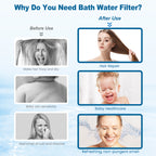 FEELSO Dual-Filter High-Pressure Shower Head